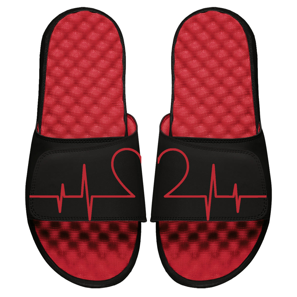 Heartbeat Slides
